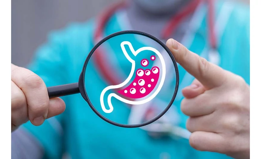 Reflux és a gyógynövények